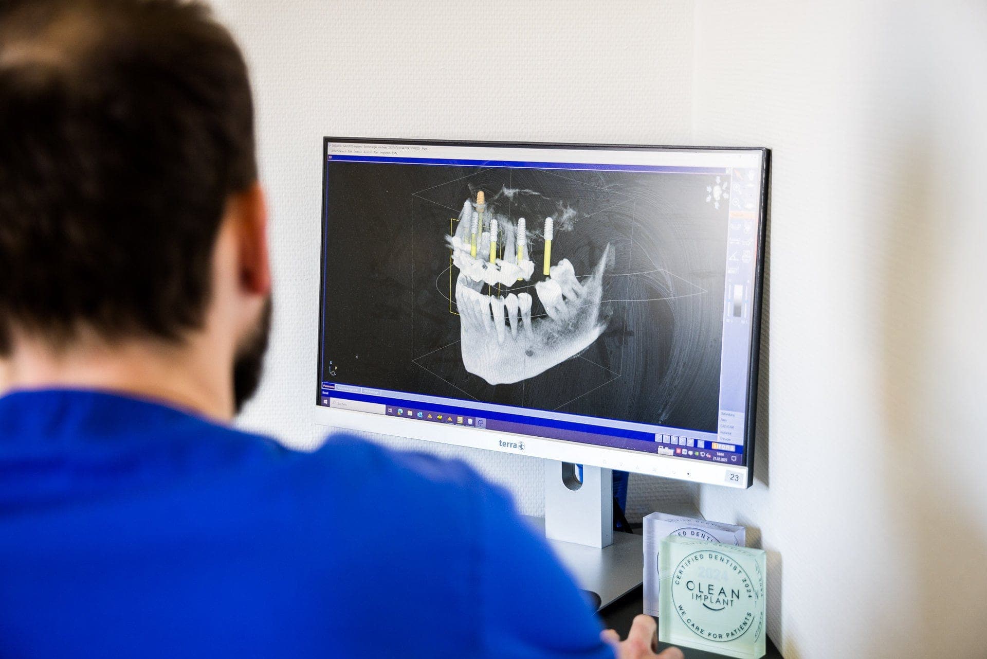 Zahnarztpraxis für Oralchirurgie - Sonnenpark Leipzig - Zahnimplantate (20)